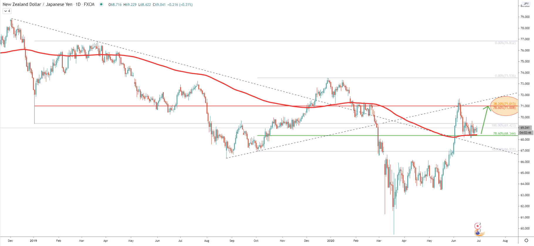 NZD/JPY Daily Technical Analysis 29 June 2020